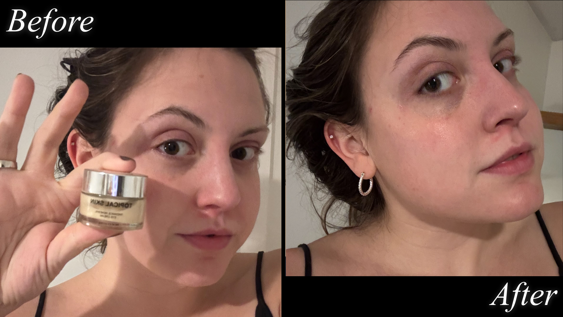 Contributing beauty writer Sophia Vilensky before and after testing Topical Skin&#039;s eye cream.