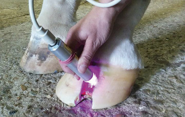 First treatment with Quantum Laser