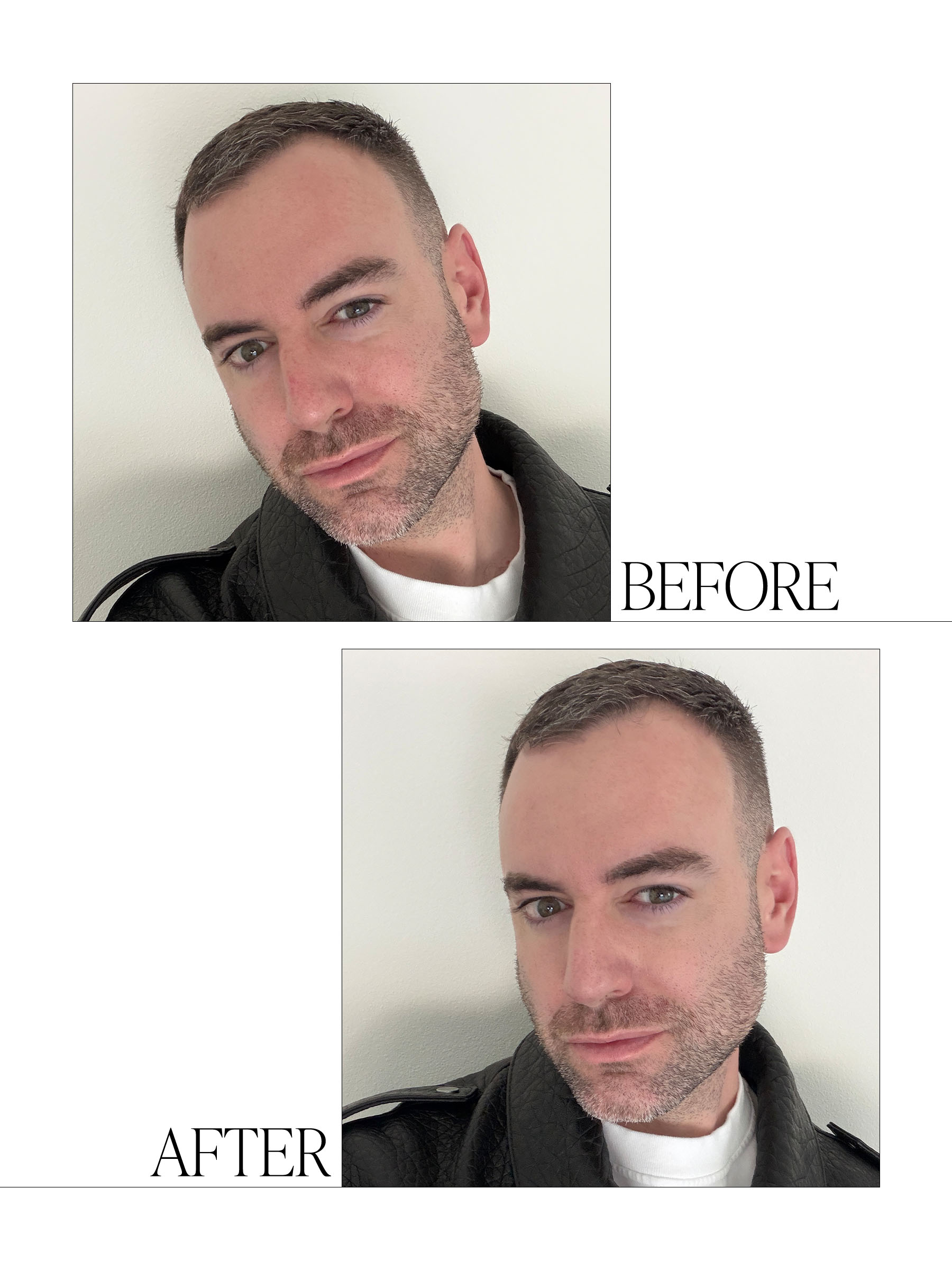 The best Chanel concealer