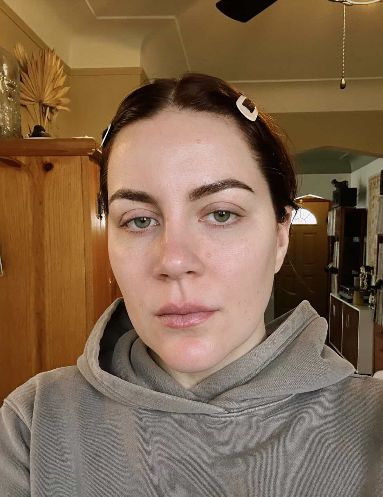 Mariah Downing during her microblading healing process.