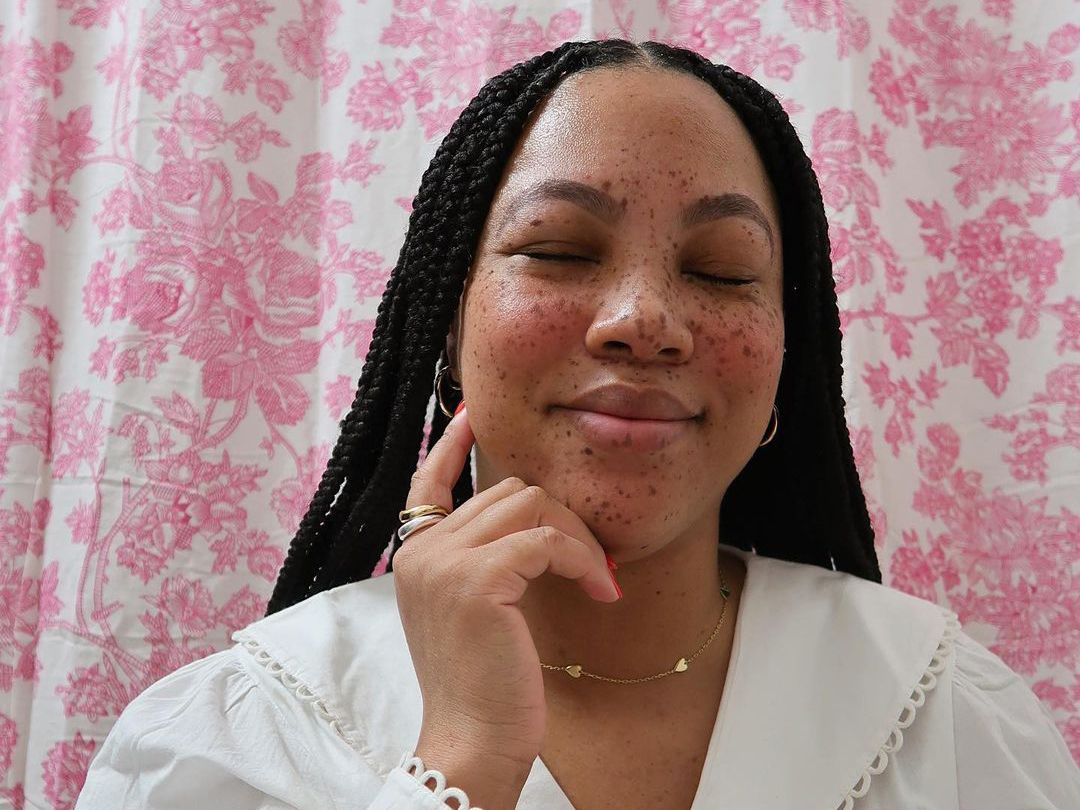 Woman with freckles