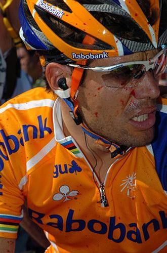 Scary sight: a bloodstained Oscar Freire