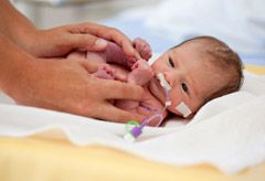 Premature baby - World News - Marie Claire