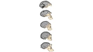 Οι εξελίξεις στην τεχνολογία απεικόνισης επέτρεψαν στους ερευνητές να δημιουργήσουν λεπτομερείς τρισδιάστατες ανακατασκευές των πέντε κρανίων Homo erectus από το Dmanisi της Γεωργίας.