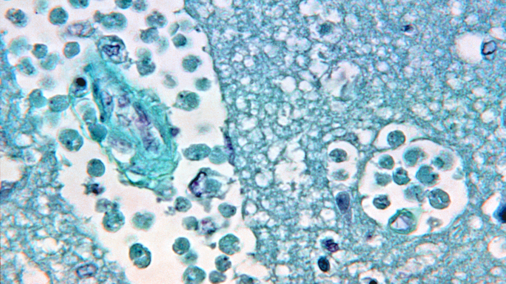 A photo of Naegleria fowleri, a parasite that’s often called the “brain eating” amoeba.