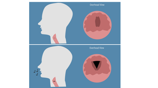 This diagram shows how the human vocal cords produce sound.