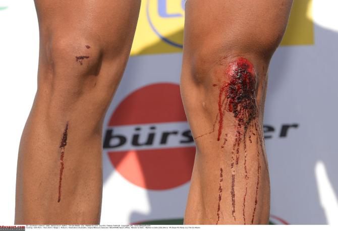 Blood on the podium: Nacer Bouhanni (FDJ.fr) fell during the stage