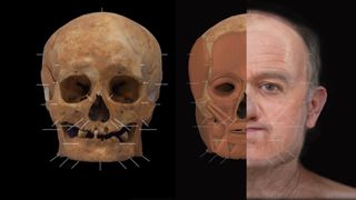 Photographs and measurements of SK125's skull helped a forensic artist build missing muscles and reconstruct the long-dead man's face.