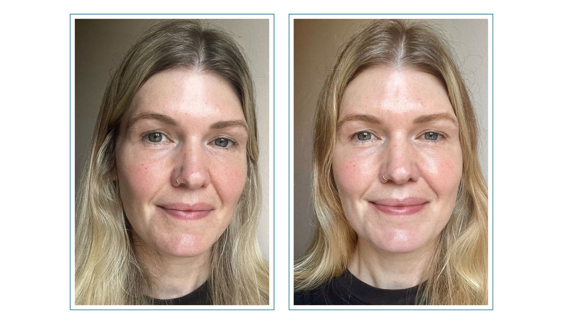 Beauty editor fiona mckim pictured with bare skin on the left, then after applying Jones Road Your Skin Foundation Stick on the right