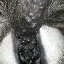 melanomas.jpg