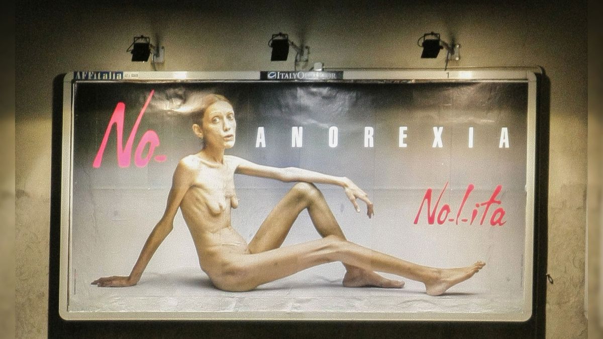 An anorexic model on a billboard for a campaign against the disease 