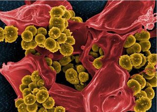 A scanning electron micrograph image of methicillin-resistant Staphylococcus aureus (MRSA) bacteria.