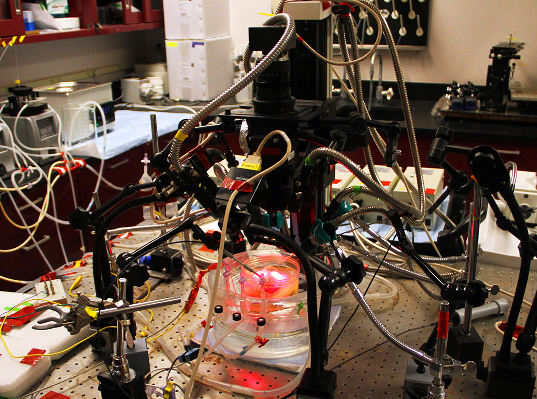 Part of a donated human heart is reanimated and recorded with four high-definition optic cameras.