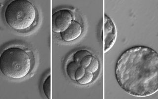 This sequence of images shows the development of human embryos after they were injected with a gene-correcting enzyme and sperm from a donor with a genetic mutation known to cause a type of heart disease. 