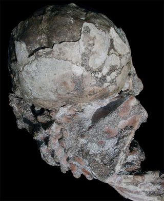 fossil remains of Selam, a 3-year-old human ancestor.
