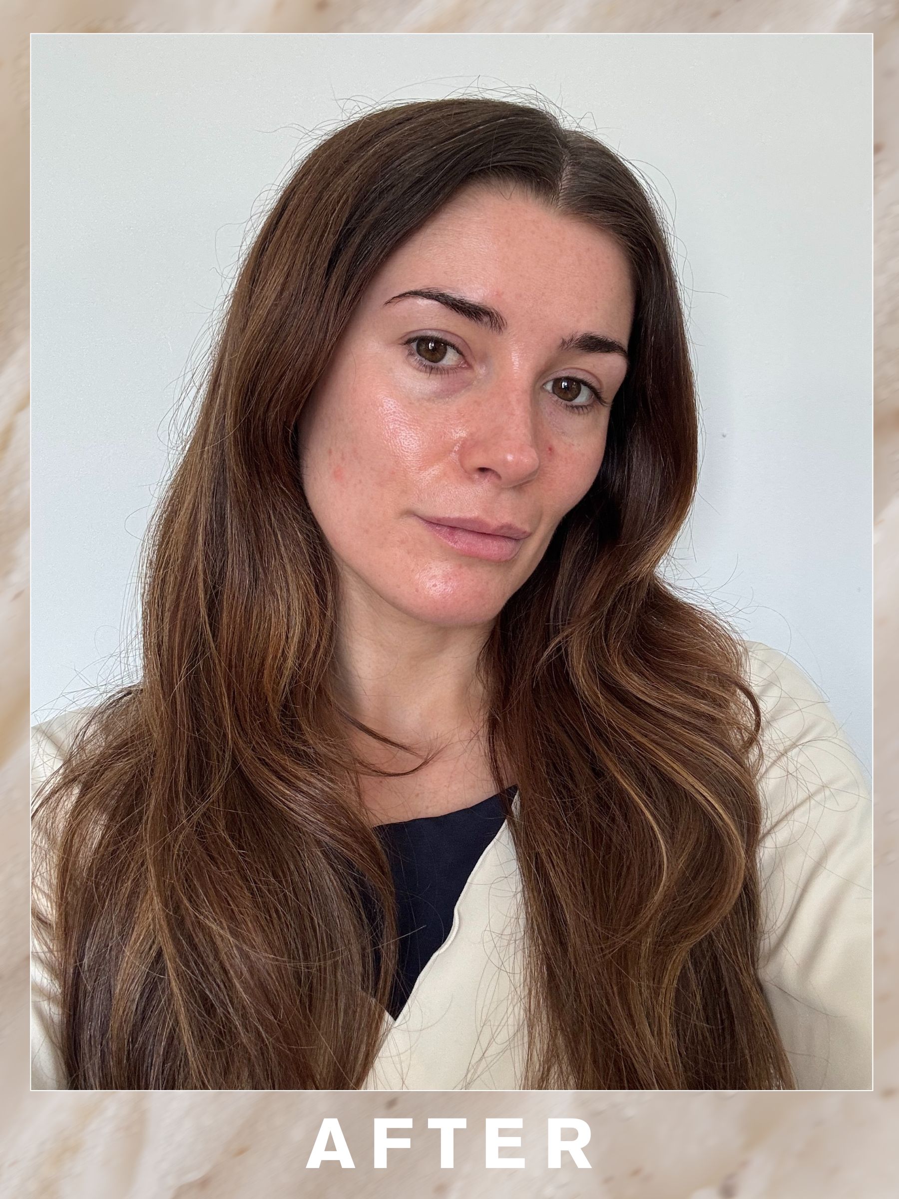 Eleanor's skin after the IS Clinical Flash Brightening Peel