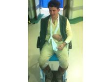 Jamie Fry, Rosie's twin brother, with a broken collarbone