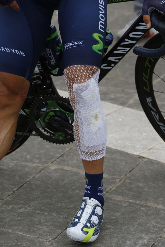Dayer Quintana's (Movistar) legs showing the effects of a crash