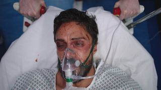 Head shot of Flynn in a hospital gown being wheeled to surgery on a trolly. He's wearing a mask for breathing and his face is covered in cuts and bruises.