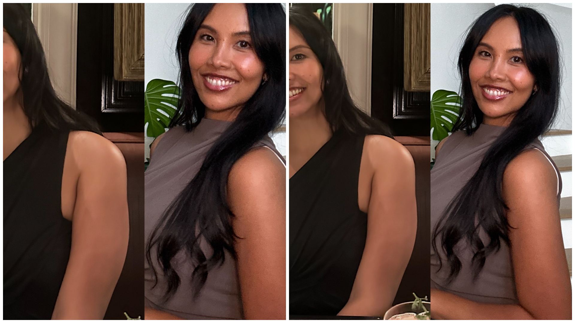 Vanessa Lee's before and after photos after Onda Pro treatments