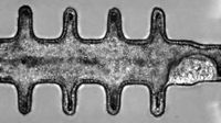 Microscope image shows a tube-like structure with four "spikes" or extended-out bits on the top and four on the bottom. A tumor can be seen beginning to form in the bottom right-hand side of the structure.