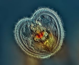 rotifer