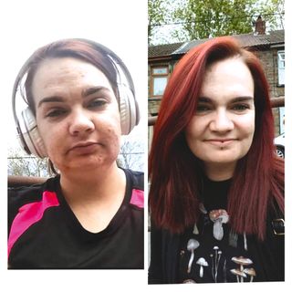 split image of woman before and after rehab