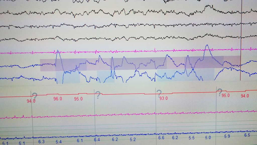 can-white-noise-help-you-sleep-better-live-science