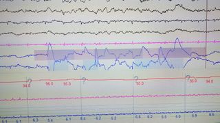 Close-Up Of Polysomnography Graph