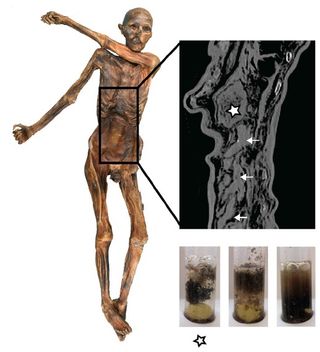 A close-up of the iceman's gastrointestinal (GI) tract. The asterisk shows the filled stomach, while the arrows point out the intestinal loops of the lower GI tract. Below are samples from the stomach (left) and two different sites in the lower GI tract (middle and right) that were rehydrated.