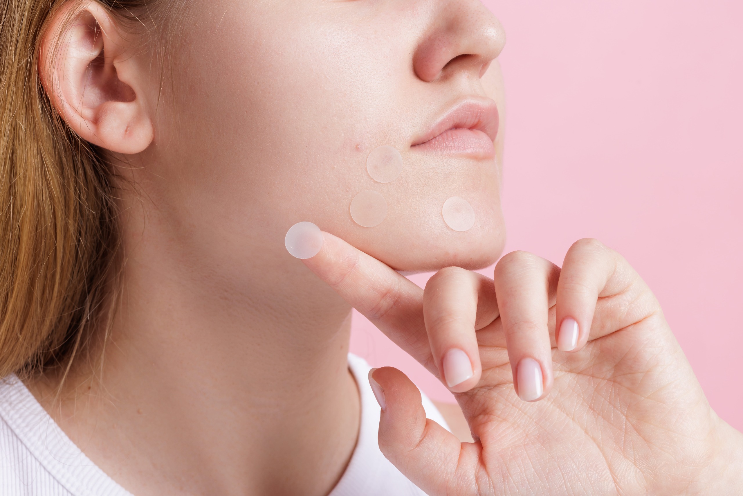 a close up of a white woman wearing acne patches