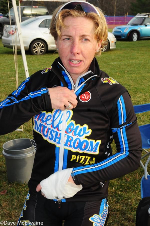 Laura Van Gilder (C3/Mellow Mushroom Pizza) had her hand bandaged after the race due to a collision with the same fence that took down Smith