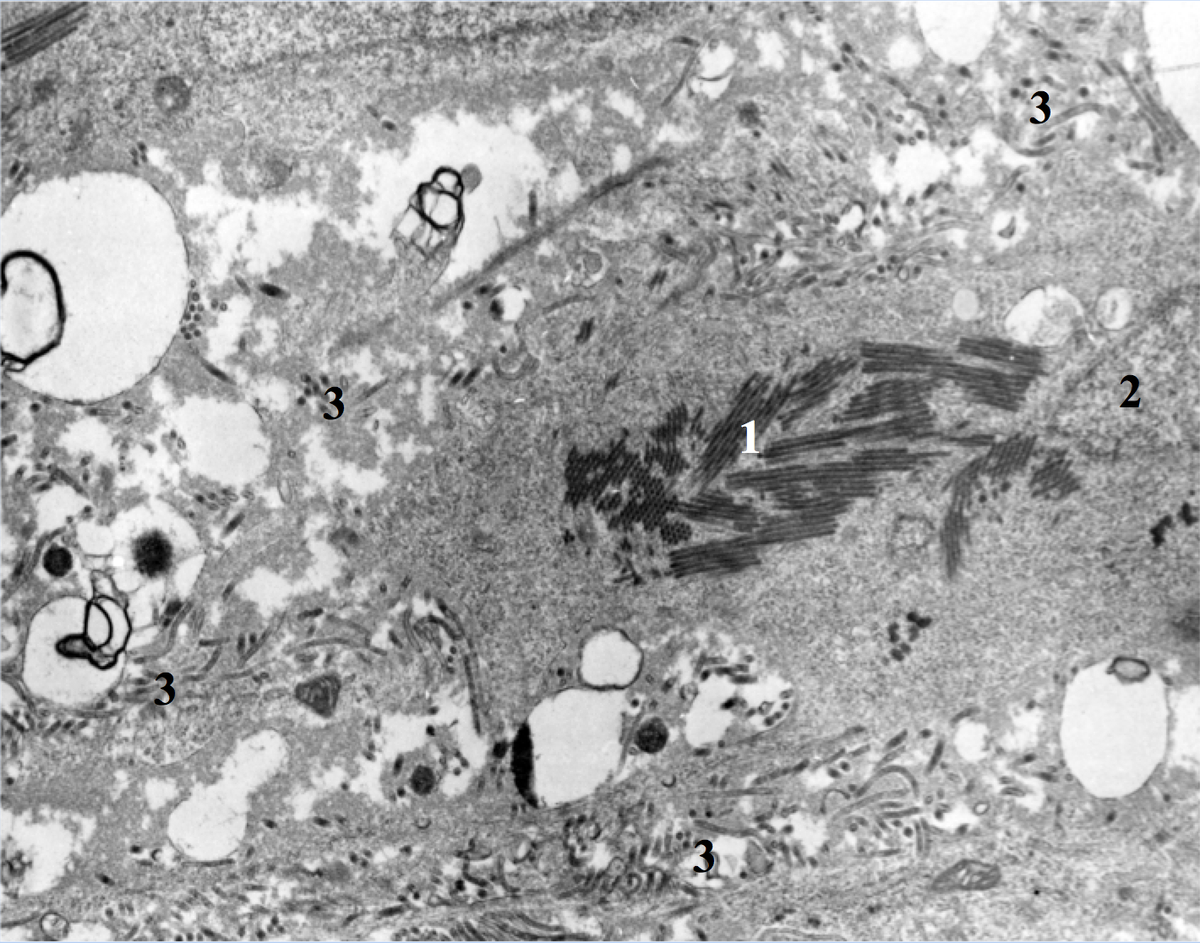 In this image, particles of Ebola virus are replicating in liver tissue.