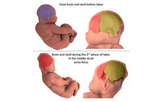 Three-dimensional digital reconstruction of the cranial bones before labor and during the second stage of labor.