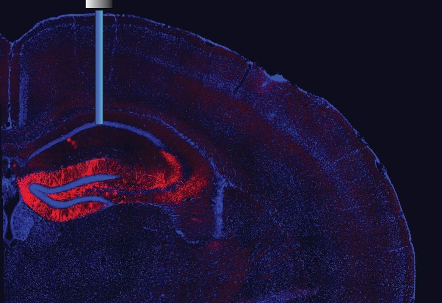 Image shows a magnified part of a mouse&#039;s brain where an optic fiber is inserted to switch neurons on and off.