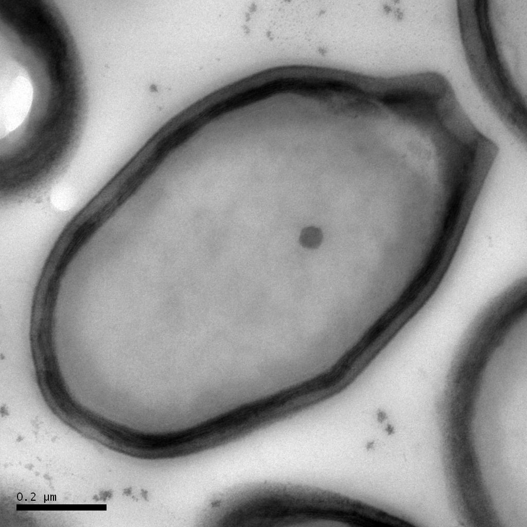 Electron microscopy image of a Pandoravirus particle