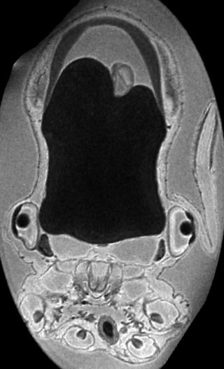 An MRI scan shows the octopus hatchling's eyes and yolk sac (the black blob in the middle).