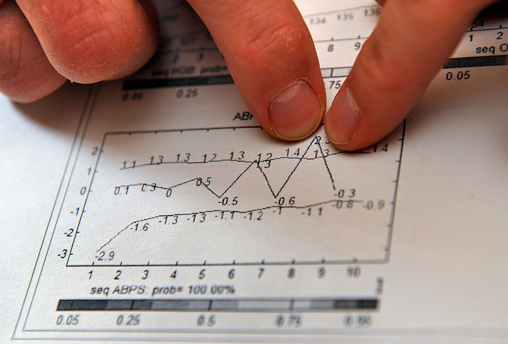 Swiss Laboratory for Doping Analysis&#039; Neil Robinson displays an example of biological passport results