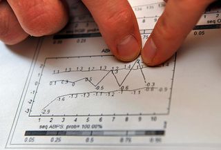 Swiss Laboratory for Doping Analysis' Neil Robinson displays an example of biological passport results