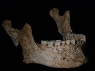 The lower jaw of an adult male found in Tomb I. This jaw may belong to Philip II, father of Alexander the Great.