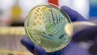 Microbiologist examining a multi-drug resistant coliform (Klebsiella pneumoniae) bacteria on CLED agar plate