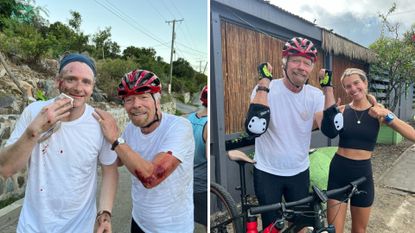 Two images of Richard Branson, one with a cut elbow, and the other in elbow pads