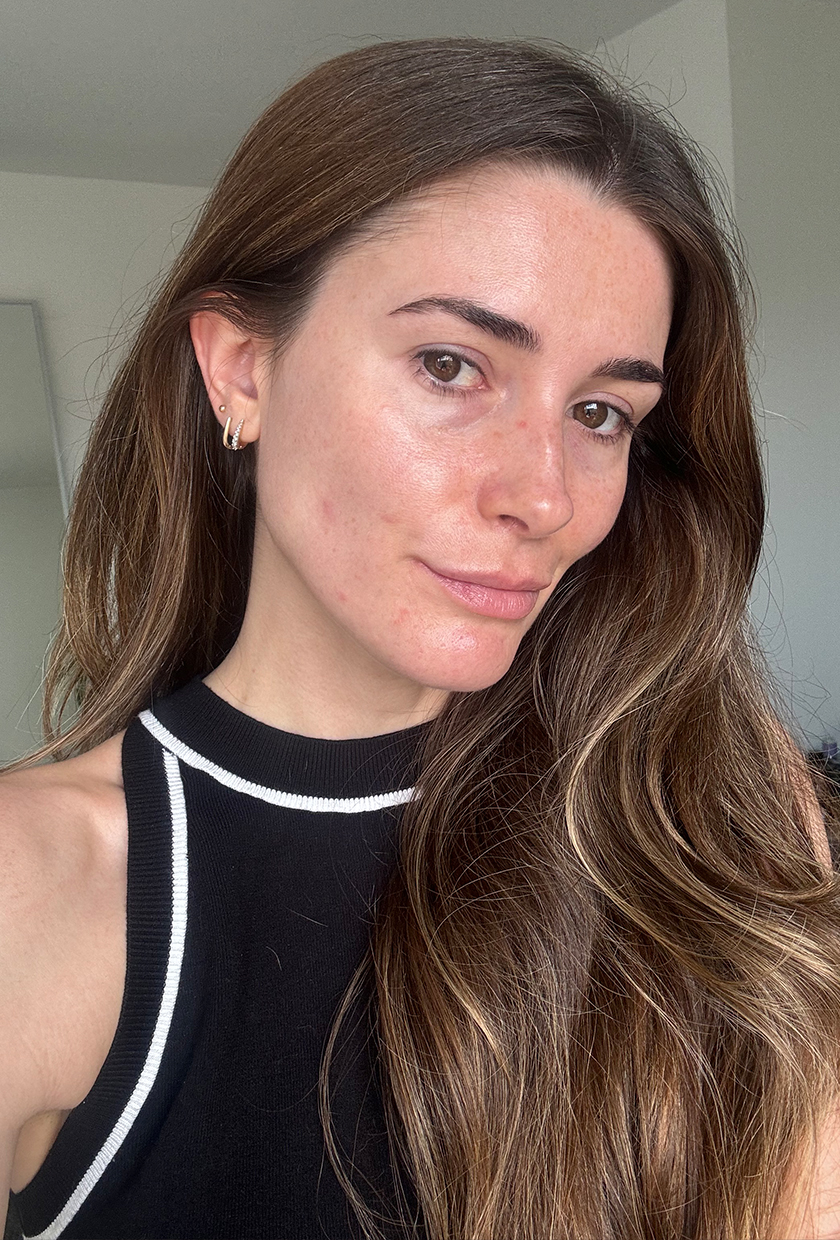 Eleanor after using Beauty Pie LED Mask
