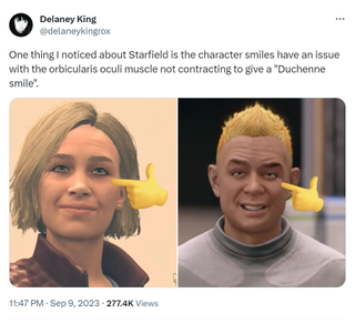 Screenshot of X post with emojis pointing out problems with Starfield characters' smiles
