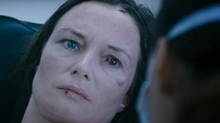 Catherine McCormack lies on a hospital bed with a blood clouded eye in 28 Weeks Later.