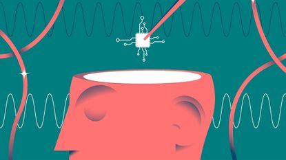 A stylized illustration of a chip being placed into a brain