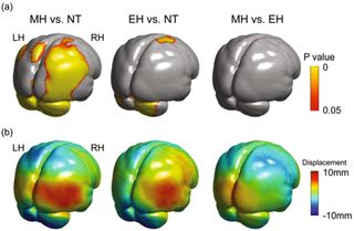 The shape displacement between early humans and Neanderthals showed how our brains mostly differed on the right side, where the cerebellum rests | Credit Kochiyama et al.