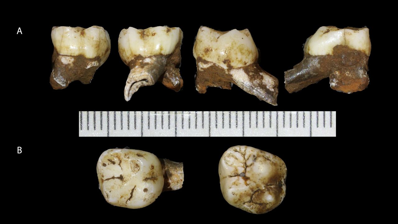 Teeth from the Homo naledi child "Leti." The teeth indicate that Leti died around the time of the eruption of the first permanent molars, which would be between the ages of 4 and 6 in modern humans.