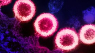 image shows HIV viral particles, depicted in pink, attached to the membrane of an immune cell, depicted in purple
