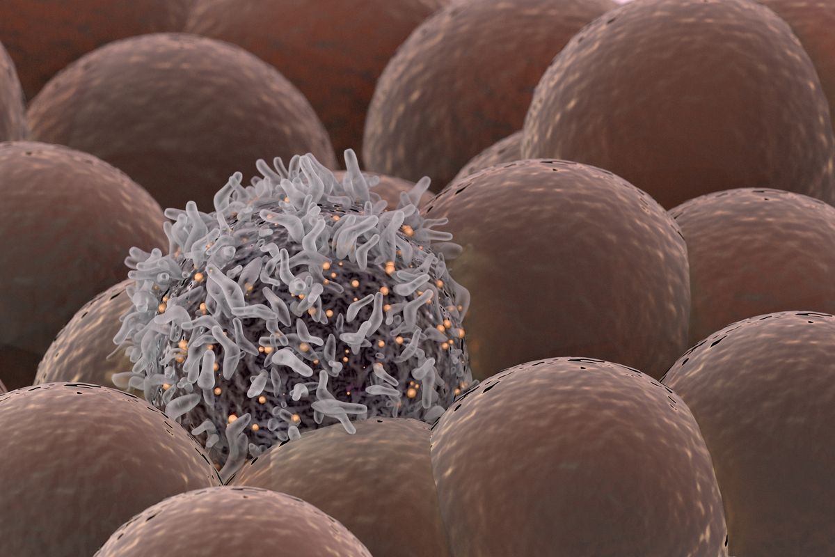 An illustration of a cancerous cell among healthy cells.